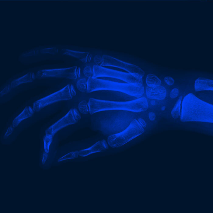 Rheumatology